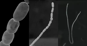 Foto da bactéria-gigante