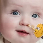 Bebê com doença rara