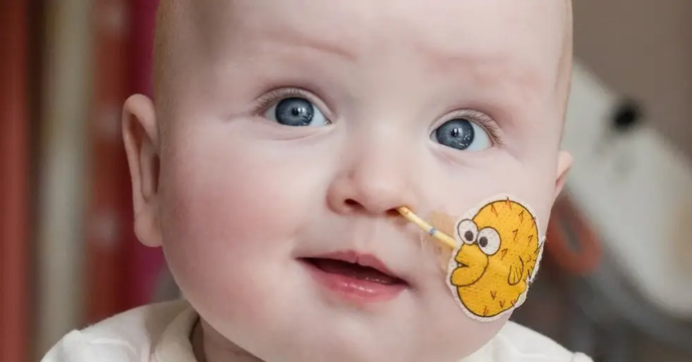 Bebê com doença rara