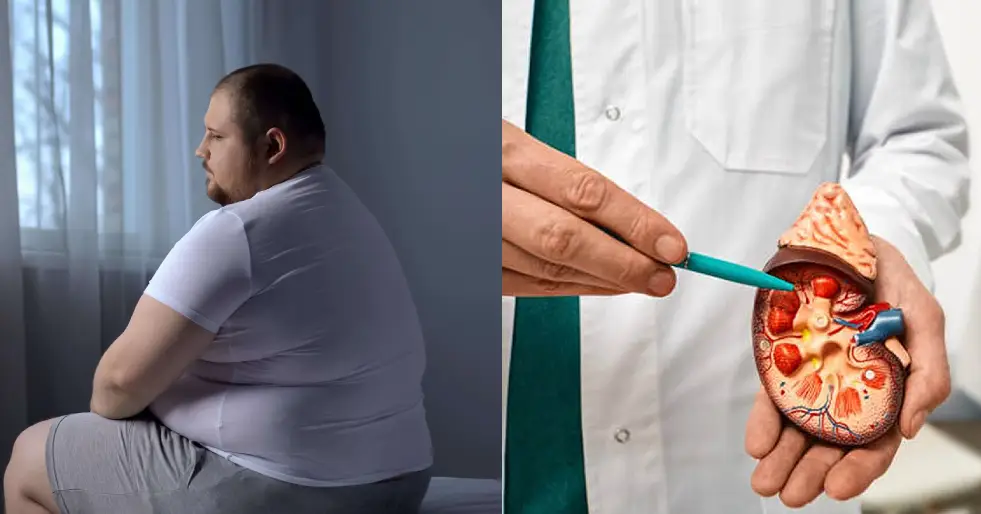Obesidade doença renal crônica